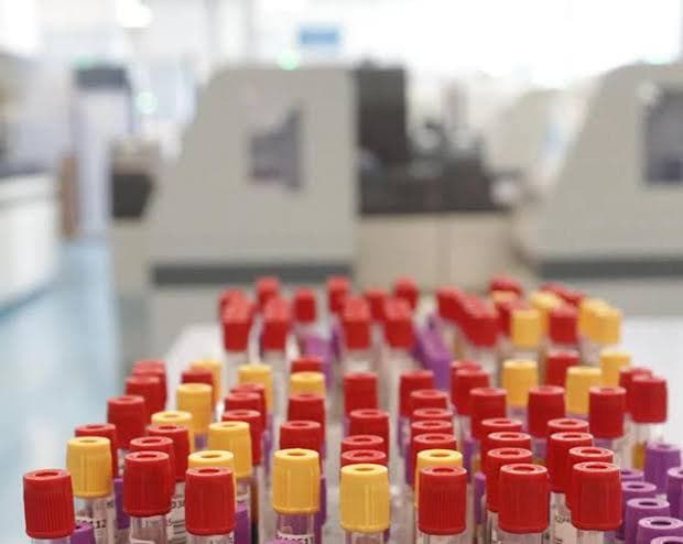 Otto casi di malaria a Francoforte: tre decessi nell'area aeroportuale